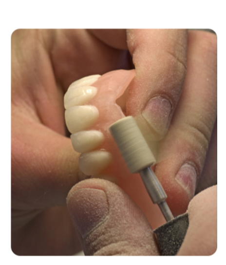 Denturologiste rafraîchissant l&rsquo;ajustement d&rsquo;une prothèse dans le laboratoire de notre clinique Smile Denture
